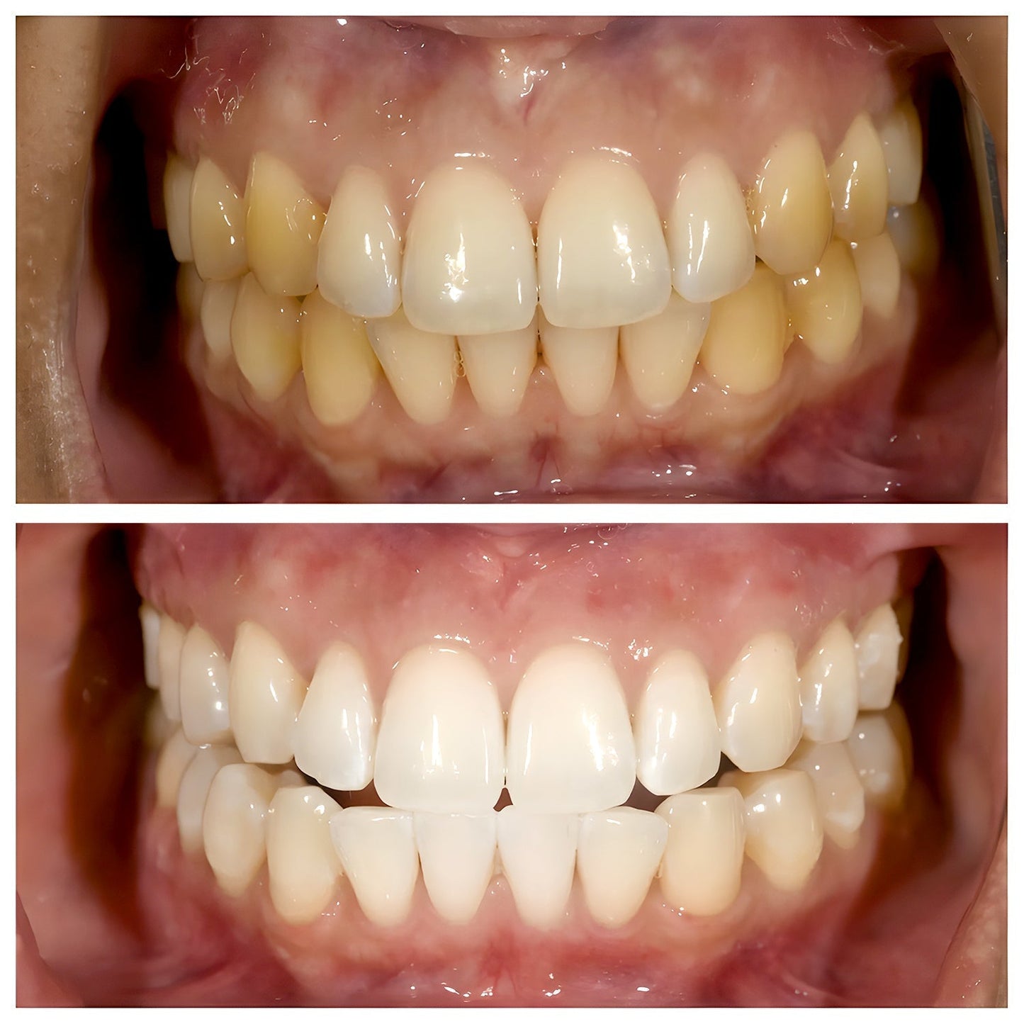 ViralLush-ToothPaste