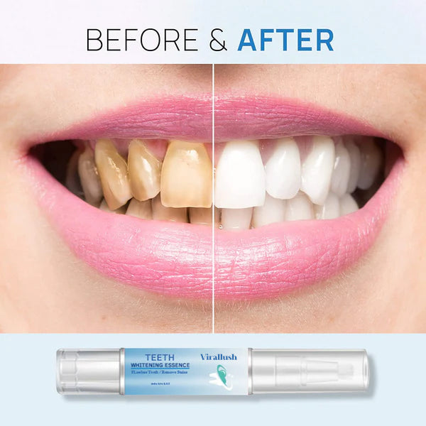 BUY 1 GET 1 FREE | Teeth Whitening Essence