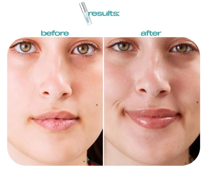 BP Spicule Plumping Lip Shot