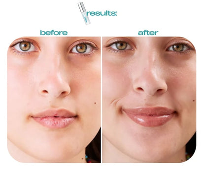 BP Spicule Plumping Lip Shot