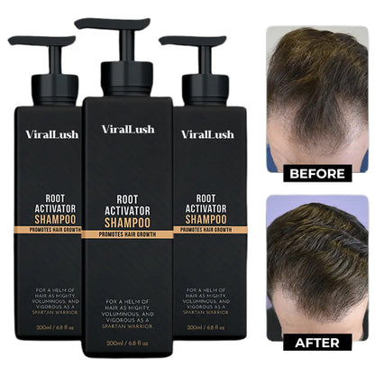 ViralLush Root Activator Shampoo