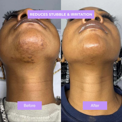 ViralLush™ - Cyperus Rotundus Skin Serum