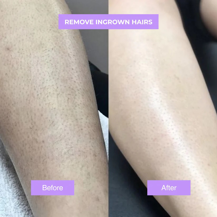 ViralLush™ - Cyperus Rotundus Skin Serum