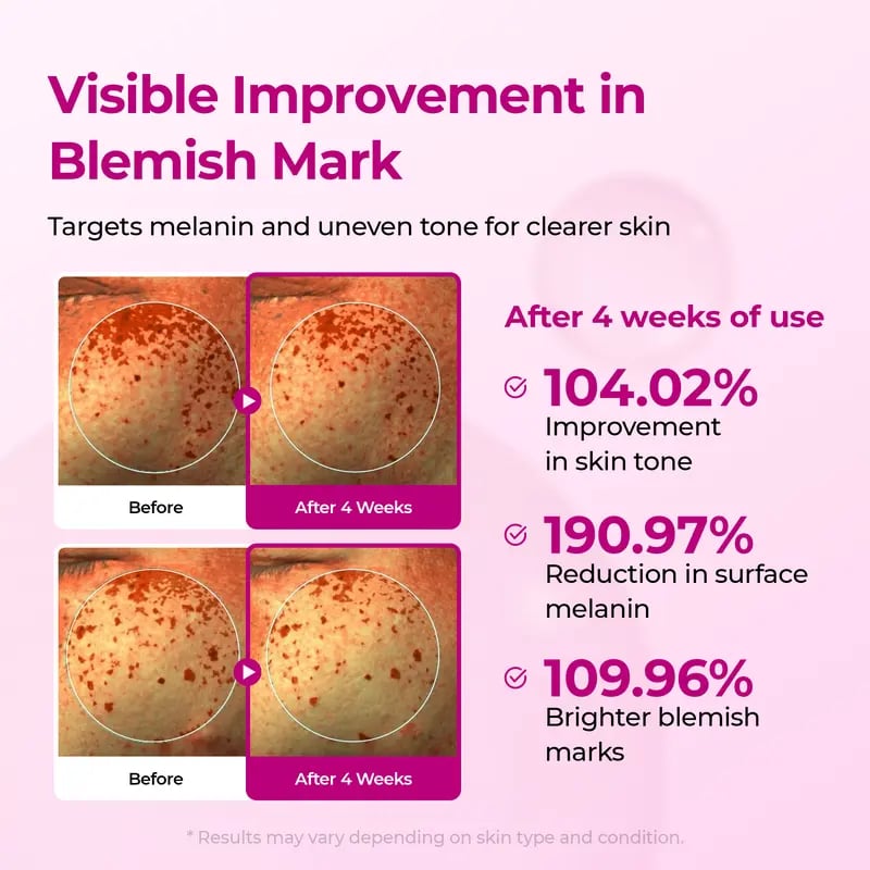 Pore & Spot Care Duo