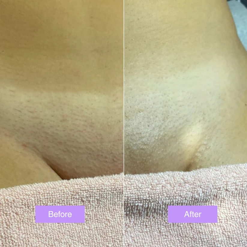 ViralLush™ - Cyperus Rotundus Skin Serum