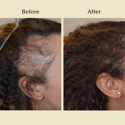 Natural Hair Growth Oil