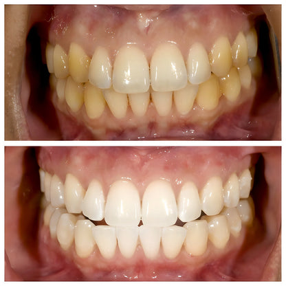 ViralLush-ToothPaste